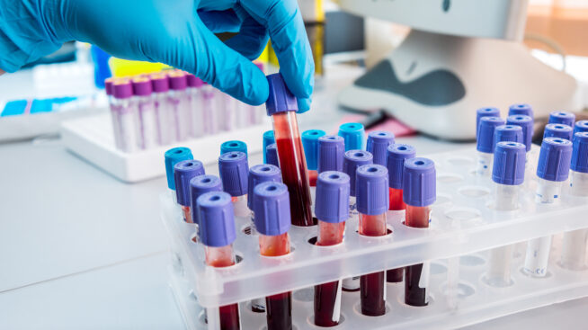 Lab worker with gloved hand picking up a test tube containing blood samples out of a test tube holder in blood testing facility