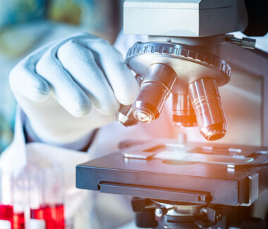 NYBCe scientist observing blood sample under a microscope