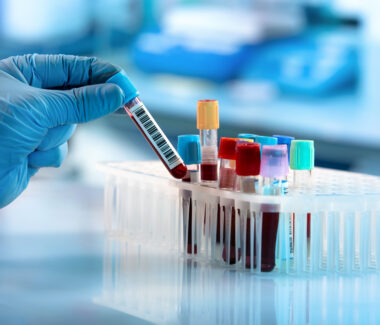 Gloved hand of lab technician holding a blood vial