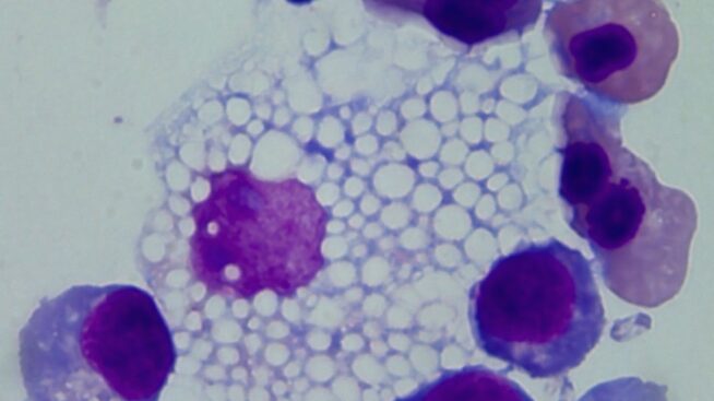 Macrophage